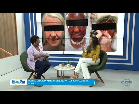 Dermatologista alerta sobre nova técnica “Peeling de Fenol” 21 11 2022