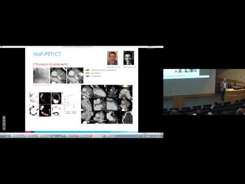 Edinburgh Imaging Opening Symposium - Cardiovascular Disease talks