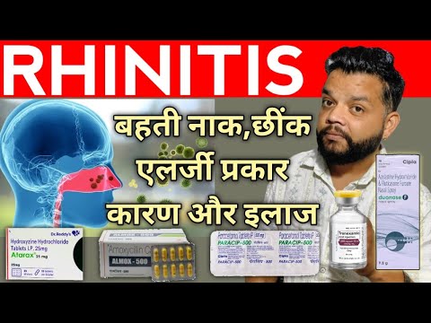 Rhinitis Complete Allopathic Treatment In Hindi | Rhinitis Causes, Symptoms And Treatment 