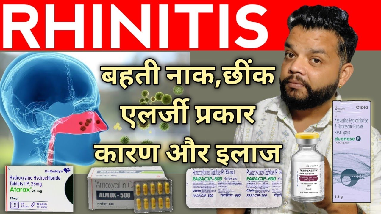 Rhinitis Complete Allopathic Treatment In Hindi | Rhinitis Causes, Symptoms And Treatment 