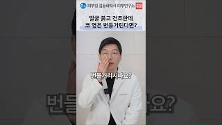 당김·번들거림·각질이 함께 있다면 지루성 피부염 확인