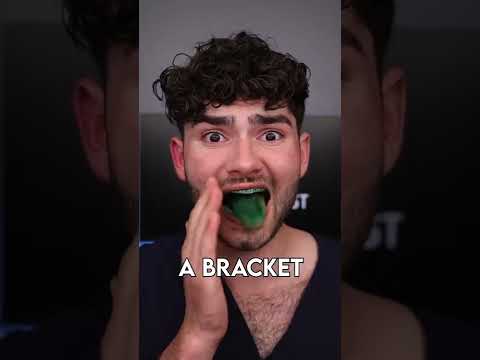 Best Braces Snack - Sour Edition!! #shorts