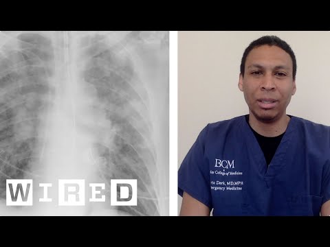 新型コロナウイルスと闘う醫療現場は、どれだけ危険なのか？の醫師が語った | WIRED.jp (新型コロナウイルスと闘う医療現場は、どれだけ危険なのか？ ERの医師が語った | WIRED.jp)