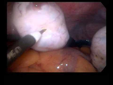 Rajani Hospital Video 6