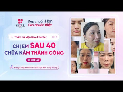 Dứt Điểm Nỗi Ám Ảnh Nám Cho Chị Em Sau 40 Tại Seoul Center