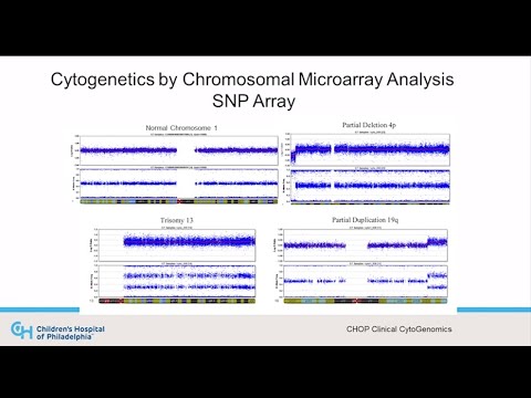 12  Chromosomal microarray testing
