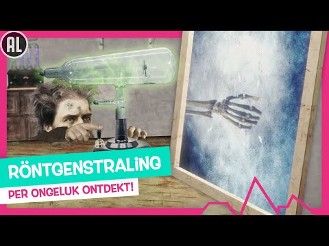 JE BOTTEN OP DE FOTO! 🩻📸 - TOPDOKS VAN TOEN