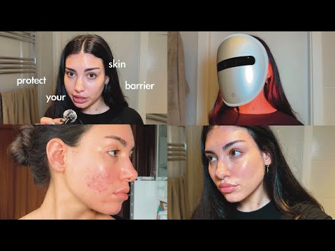 how to build your perfect skincare routine (acne friendly)