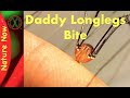 Daddy Long Legs - Myth or Legend?