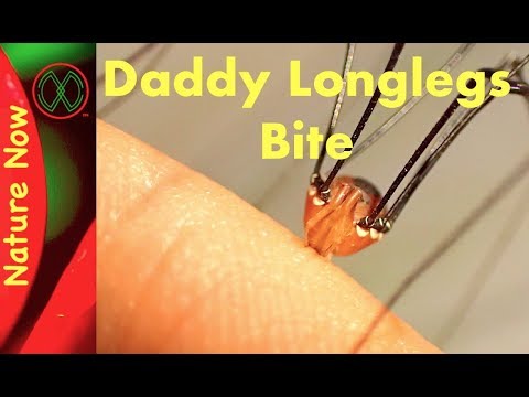 YouTube video about: What happens if a cat eats a daddy long legs?