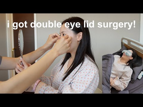 I Got Double Eyelid Surgery In KOREA | 1 Week Aftercare vlog