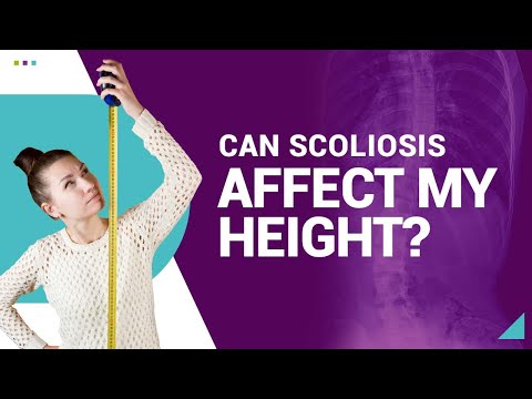 YouTube video about: Does scoliosis make you shorter?
