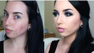 ACNE COVERAGE + Royal Blue Smokey Eye | Get Ready With Me