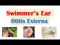 Swimmer’s Ear (Otitis Externa) | Risk Factors, Causes, Signs & Symptoms, Diagnosis, Treatment