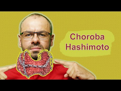 Unknown facts about Hashimoto's disease