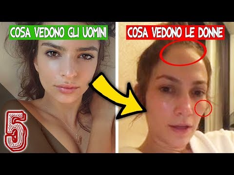 Il pigmentary nota in cuore Trattare pigmentary nota un corpo