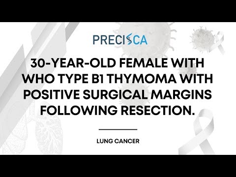 Expert Cancer Panel: WHO type B1 thymoma with positive margins following resection