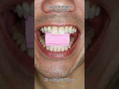 This is the ASMR video that got 400K views in 1 day. #DoctorTristanPeh #shorts🎉🎉🔥🎉🎉