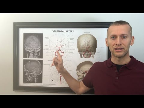 Is your brain stem getting the blood flow it needs? What are the effects of a kinked upper neck?￼
