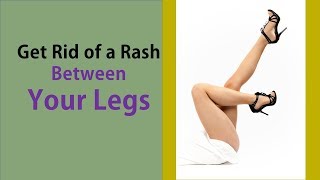 How to Get Rid of a Rash Between Your Legs - Treating the Rash &  Relieving Itchiness