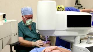 Blade-Free Custom LASIK Surgery in Dubuque, IA
