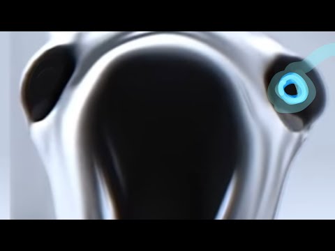 Video thumbnail for Exposed Nerve With Lyrics: The Musical (please laugh)