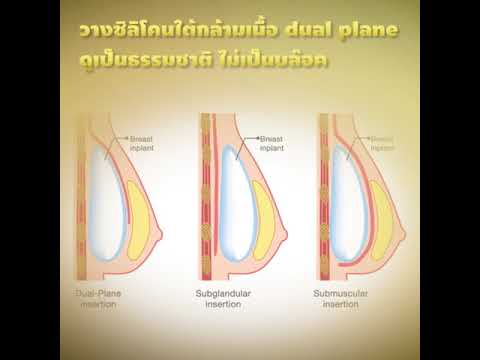 ไม่ว่าจะเป็นไปได้ที่จะเพิ่มหน้าอกโดยไม่ต้องพลาสติก ทำไมหน้าอกเล็กไม่ได้เติบโต
