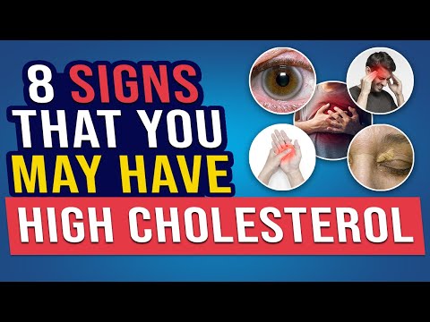 High Cholesterol Alert : 8 Symptoms You Shouldn't Ignore | Normal Cholesterol Level