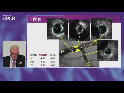 Distal left main stenosis: how to treat optimally with dedicated bifurcation stent BiOSS Lim C.