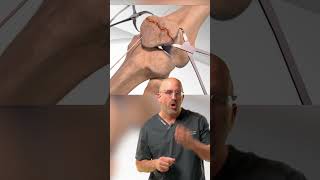 Shattered Kneecap 🔨 Repair #shorts