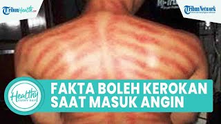 Bolehkah Kerokan Saat Masuk Angin, Begini Manfaat dan Faktor Risiko untuk kesehatan Tubuh