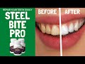 Steel Bite Pro Review: Watch This Before You Buy Steel Bite Pro Supplement