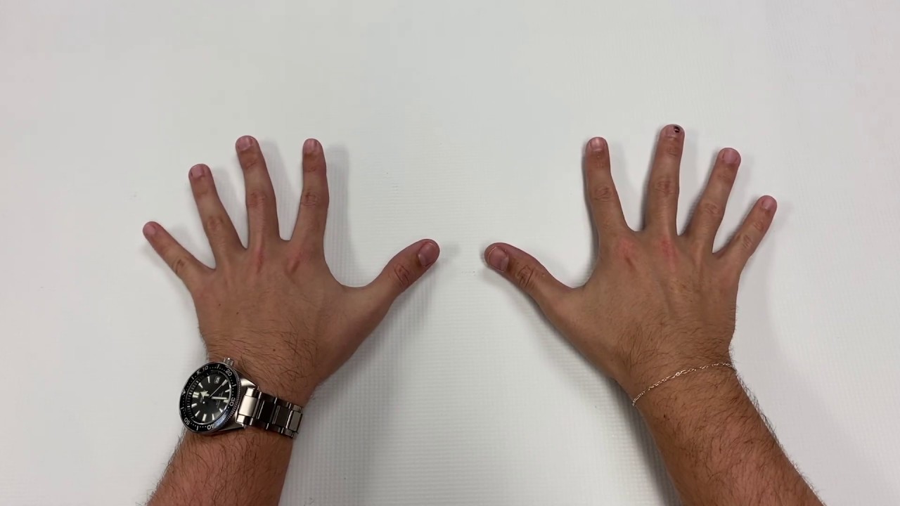 Finger and Wrist Range of Motion