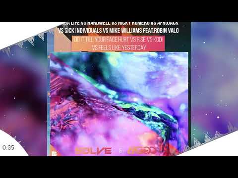 Dada Life Vs Nicky Romero Vs Sick Individuals - DITYFH Vs Rise Vs Kodi Vs FLY (SOLVE & BIGGO MashUp)