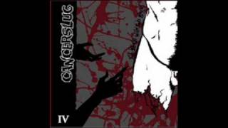 Cancerslug - The Coulda Beens
