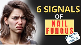 6 SIGNALS OF NAIL FUNGUS 2024 ⚠️NAIL FUNGUS ⚠️ How to treat?