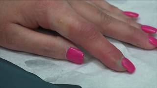 Worst Nail Infections of All Time, 2017
