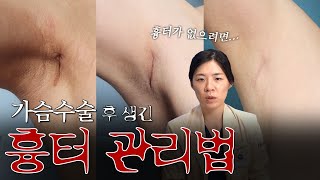 가슴성형 후 흉터, 이렇게 관리해야 안 남습니다 예방법까지 총정리!