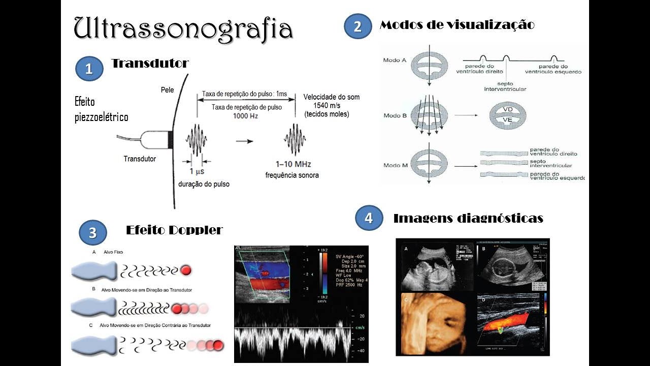 Ultrassonografia - Tópicos gerais