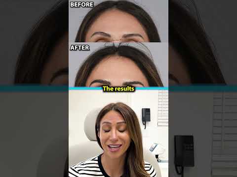 INCREDIBLE RESULTS | Eyebrow Hair Transplant With Doctor Gary Linkov
