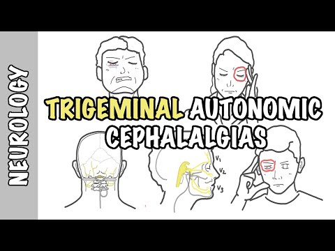 Maux de tête sévères - Comprendre les céphalées autonomes du trijumeau - types, physiopathologie, traitement