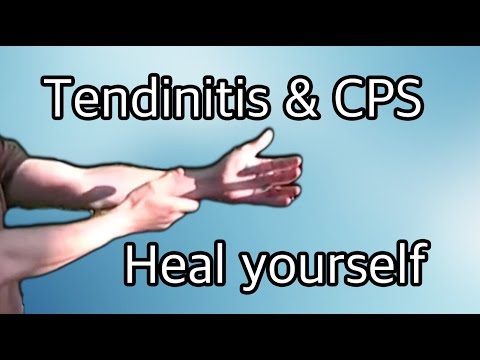 exercises for tendinitis (tendonitis) and carpal tunnel (cps)