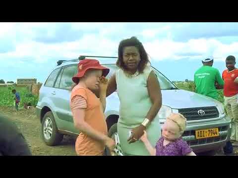 Stigmatization of the Albinism Condition in Zimbabwe, Africa