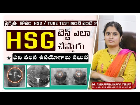 HSG - Tubal patency test