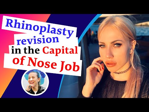 Her First Nose Job revision experience in Iran came out surprising!