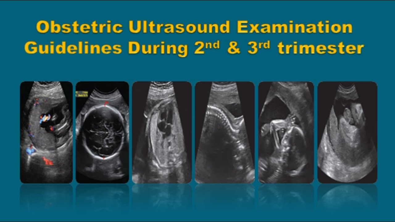 Obs Ultrasound Examination || Step by Step Guidelines for 2nd and 3rd Trimester