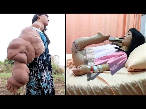 10 Most Unusual and Bizarre People To Ever Exist
