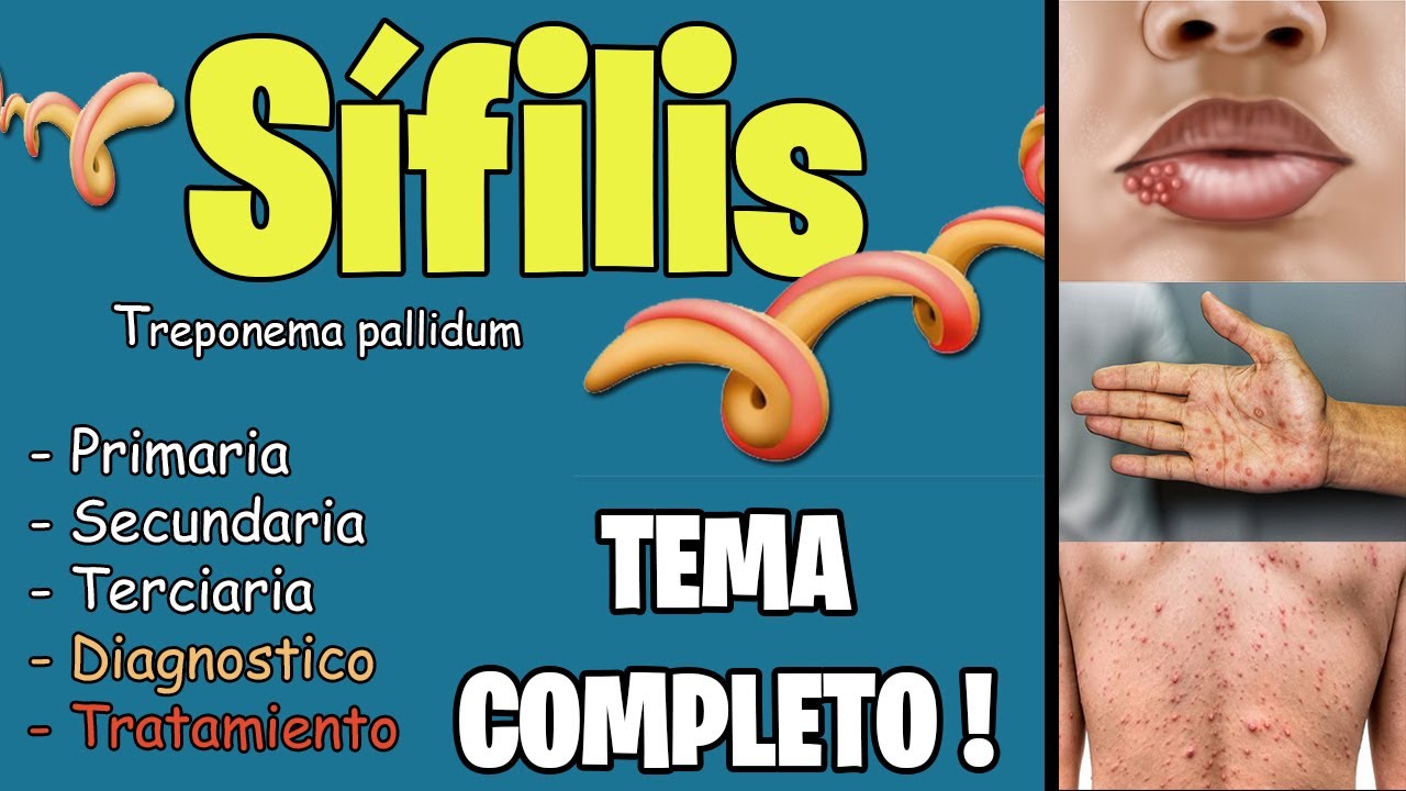 SÍFILIS : PATOGENIA, síntomas, TRATAMIENTO | Treponema Pallidum | Mejor Explicado ✅