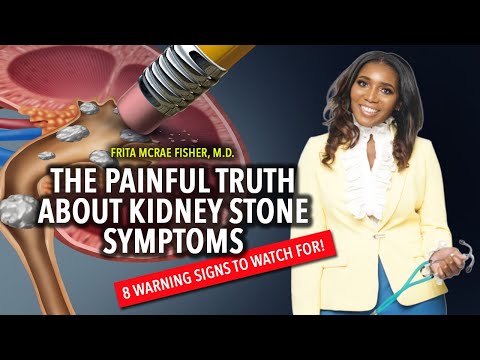 The Painful Truth About Kidney Stone Symptoms: 8 Warning Signs to Watch For