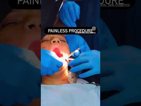 Dental implant surgery | Synergy Dental Clinic